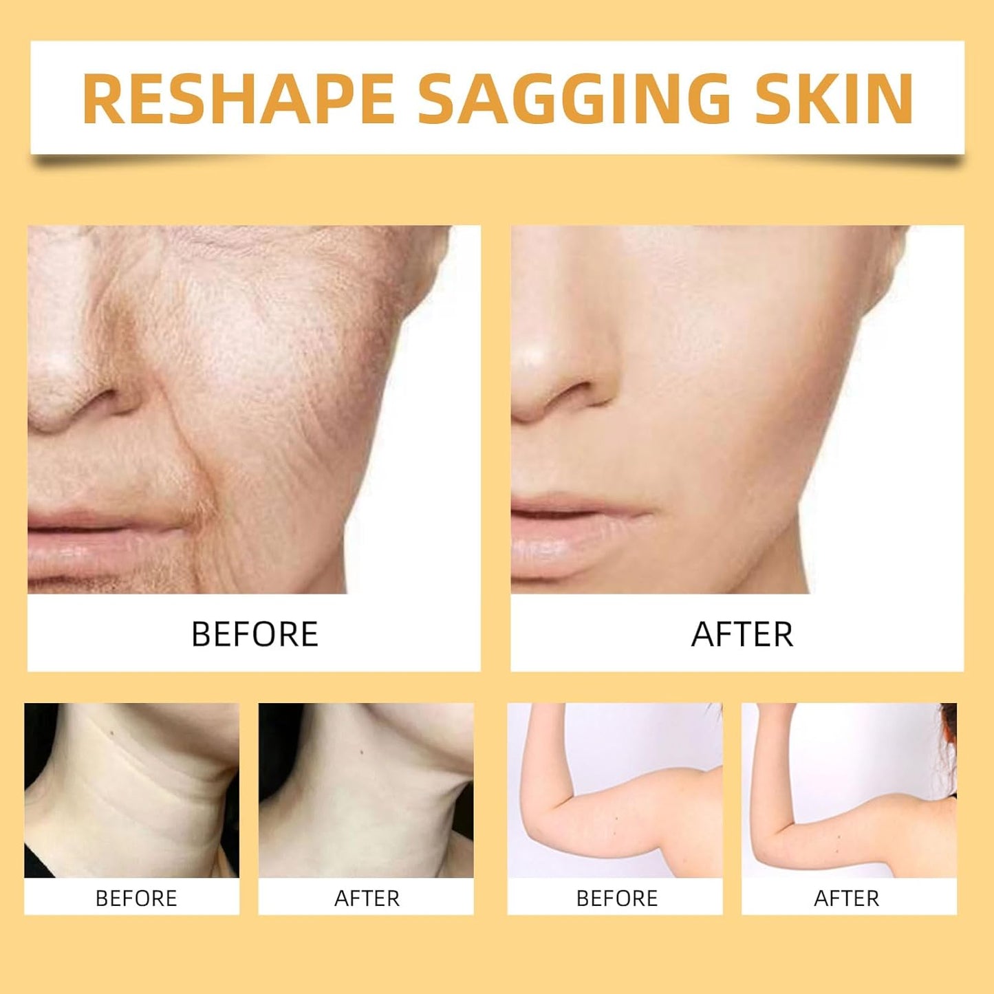 2025 New Instant Botoxin Bee Venom Firming Anti-Aging Wrinkle Removal Cream