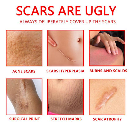 Professional and powerful scar removal gel - suitable for scar removal treatment of post-operative scars, caesarean section scars, keloids, burns, acne