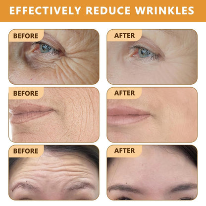 2025 New Instant Botoxin Bee Venom Firming Anti-Aging Wrinkle Removal Cream