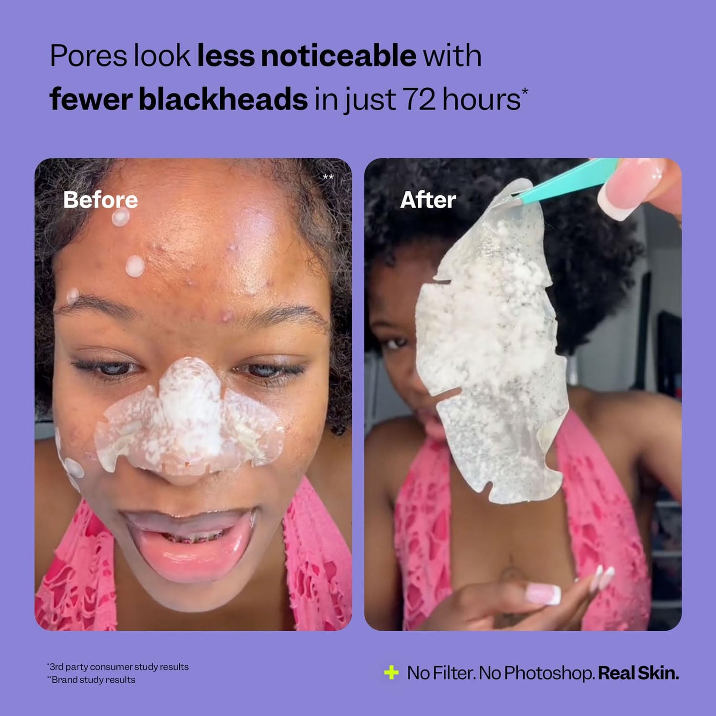 Nose Pore Patches