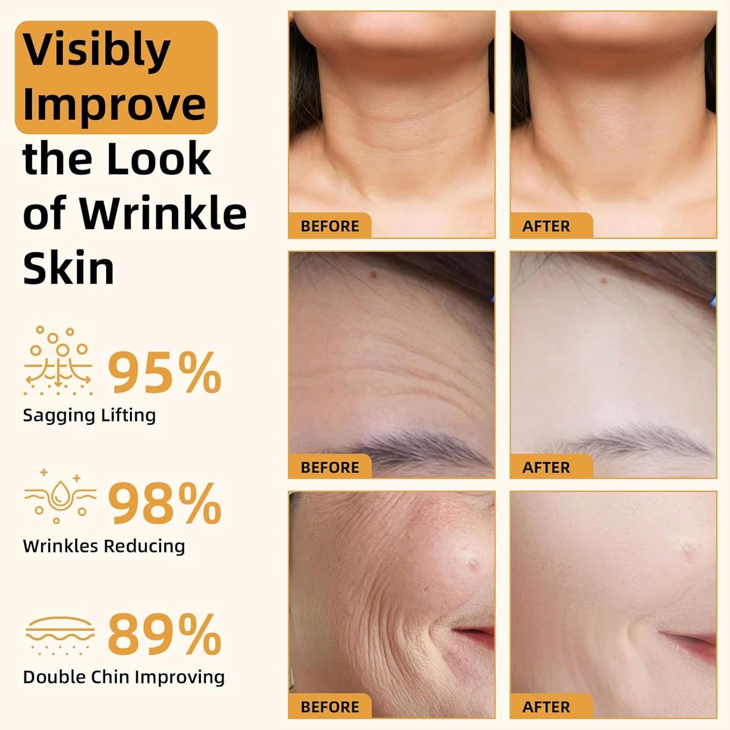 2025 New Instant Botoxin Bee Venom Firming Anti-Aging Wrinkle Removal Cream