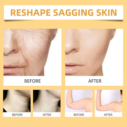 2025 New Instant Botoxin Bee Venom Firming Anti-Aging Wrinkle Removal Cream