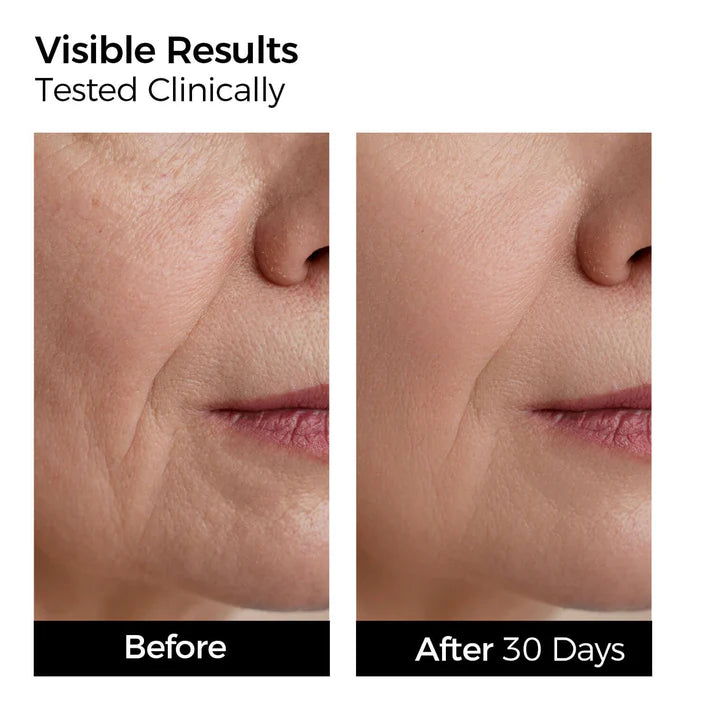 3% Hyaluronic Acid Restoration Serum