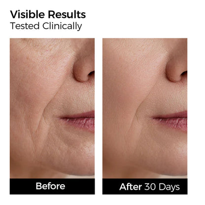 3% Hyaluronic Acid Restoration Serum